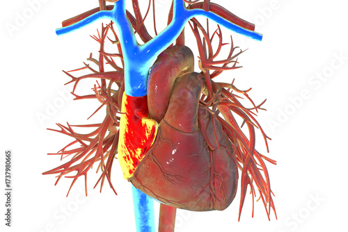 Right atrium, superior and inferior vena cava, 3D illustration