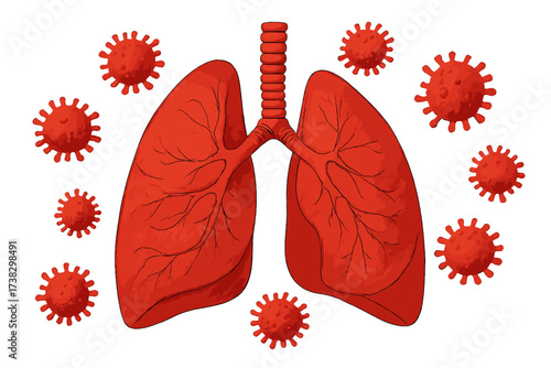 Human lungs infected by coronavirus. Covid-19 virus cells and respiratory system. Pneumonia disease concept. Pandemic, virology, healthcare, medical vector illustration.