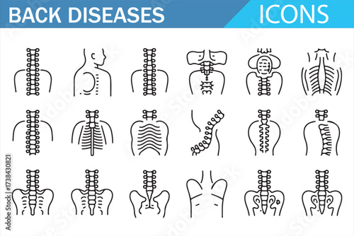 Collection of Back Disease Icons Featuring Scoliosis, Hernia, and Pain