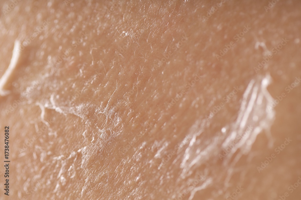 Fototapeta premium Closeup view of woman with dry skin