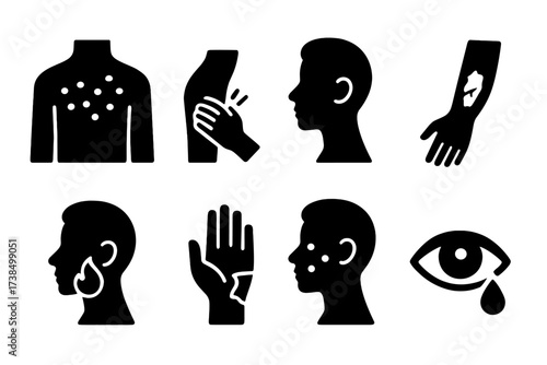 Irritation Symptoms Icons. Solid, filled icon set of irritation symptoms: red rash, itching skin, swelling, dry patches, burning sensation, peeling skin,
