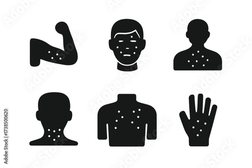 Black Rash Icons. Solid, filled icon set of rash affected areas: arm, leg, face, back, neck, chest, hand, foot. Solid, filled icons in only black color. All