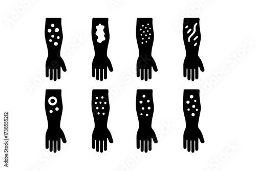 Rash Type Icons. Solid, filled icon set of rash types: hives, eczema, psoriasis, contact dermatitis, fungal rash, heat rash, drug rash, viral rash. Solid,