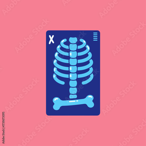 A stylized illustration of a chest X-ray showing a rib cage and a femur bone against a pink background.