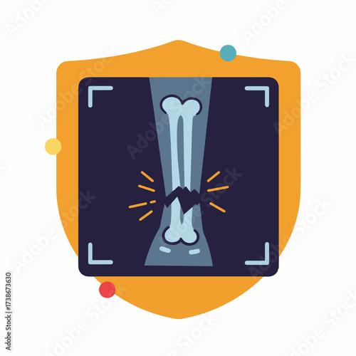 An illustration of a broken bone on an X-ray, symbolizing injury and medical care.