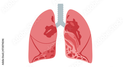 Stylized human lungs showing internal damage and disease, perfect for medical education and health awareness campaigns