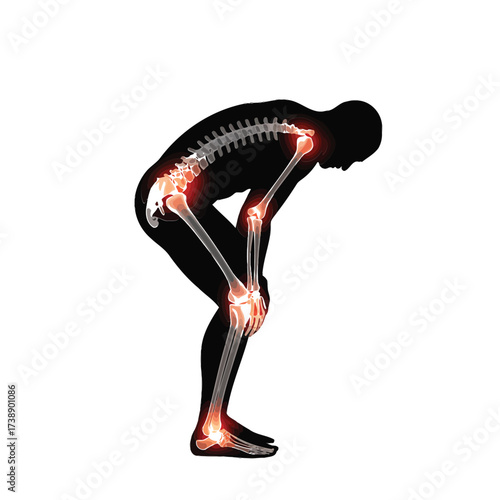 Human skeleton with glowing joints indicating pain or inflammation