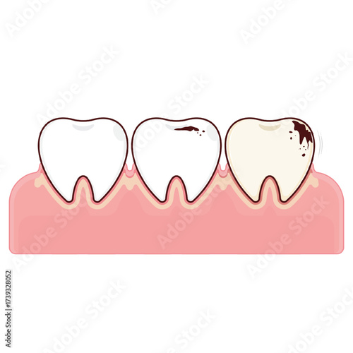 Teeth decay on the gums cartoon cute
