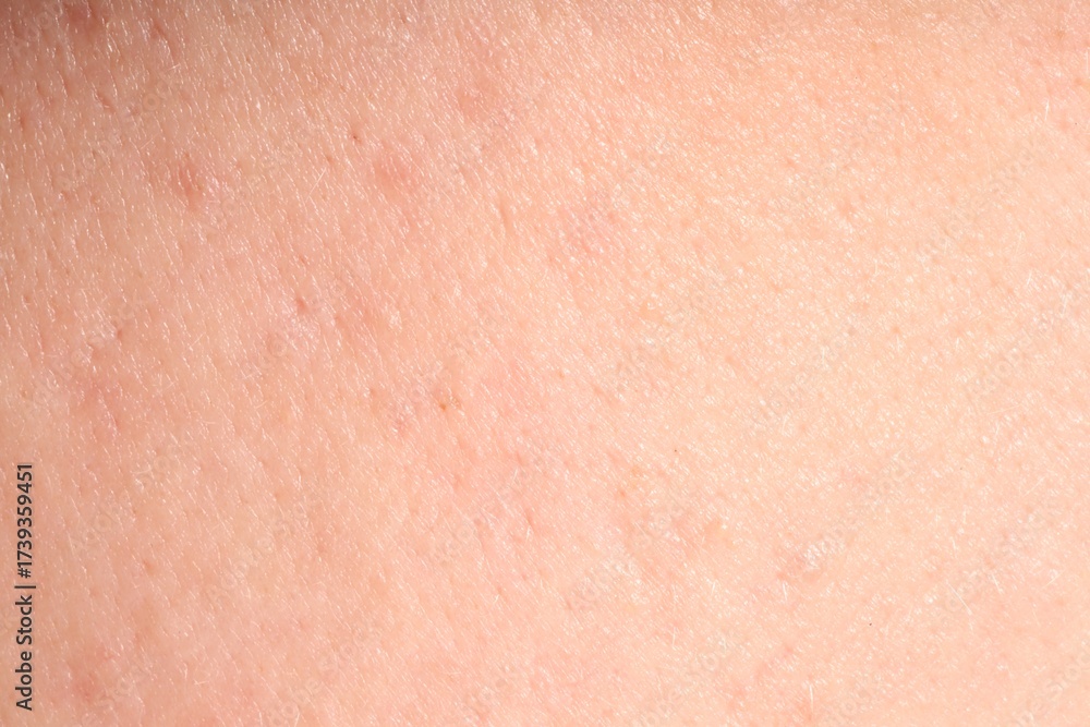 Fototapeta premium Human skin, closeup view. Detailed texture of surface