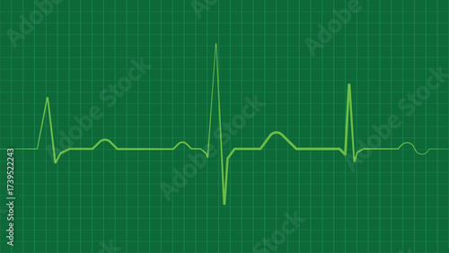 Green electrocardiogram heartbeat line on dark background