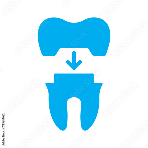 Dental Implant Concept