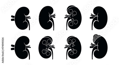 Silhouettes of eight human kidneys showing different internal structures and conditions Keywords: kidney, human kidney, anatomy, organ, medical, health, healthcare, biology, science, urology