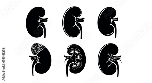 Six Black Silhouettes of Human Kidneys Showing Different Anatomical Views and Conditions anatomy medical