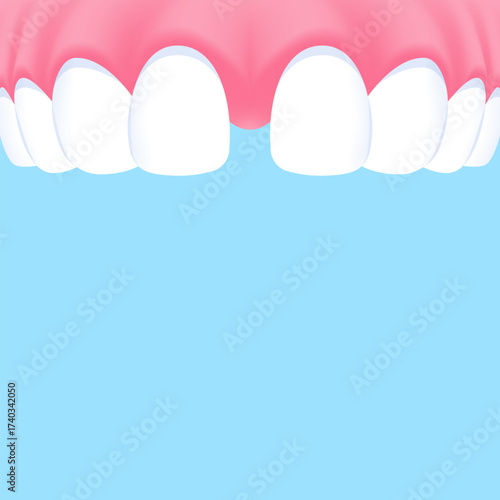 Upper teeth (Diastema) - Text box banner (square) illustration vector design. Dental care concept.