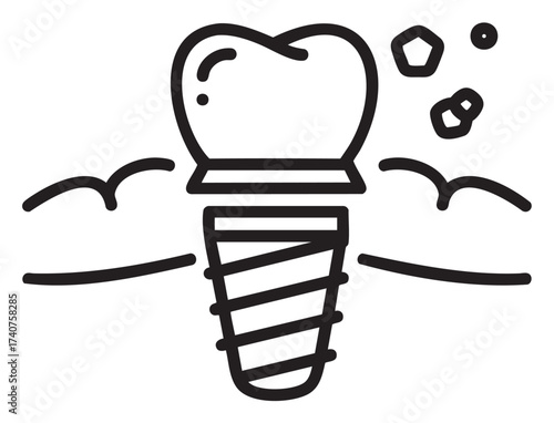 Black outline vector icon of a dental implant with a tooth crown, surrounded by abstract geometric shapes and curved lines.