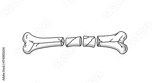 Broken Bone Fracture Vector Icon, Orthopedic Injury Anatomy Outline Line Art