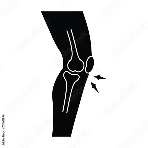 Simple black and white illustration of a human knee joint with pain