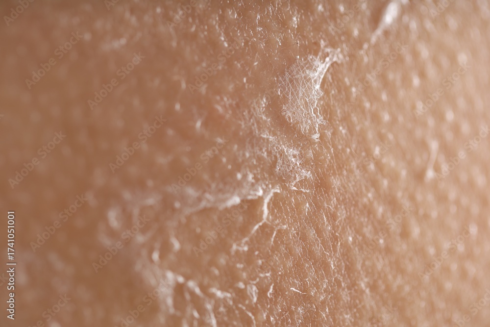 Fototapeta premium Closeup view of woman with dry skin