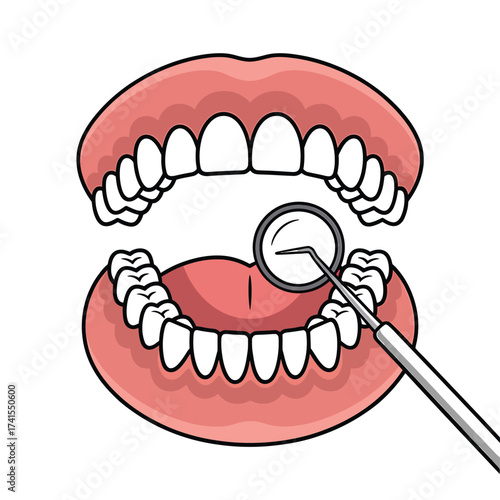 Close up of open mouth with dental mirror examining teeth