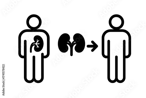 Kidney transplant vector icon showing organ donation from donor to recipient. Medical concept for surgery, urology, nephrology. Health care awareness. Human organ symbol.