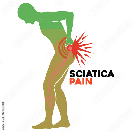 Vector art of sciatica pain illustration
