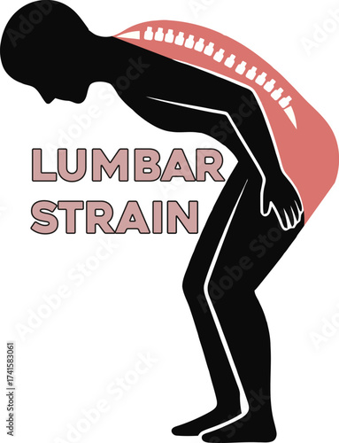 Illustration of lumbar strain and back pain