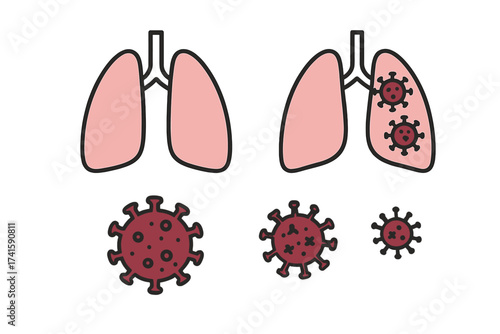 Coronavirus pneumonia vector icon set. Lungs infected by virus concept. Healthy and sick organ comparison. Medical respiratory disease illustration for infographic design.