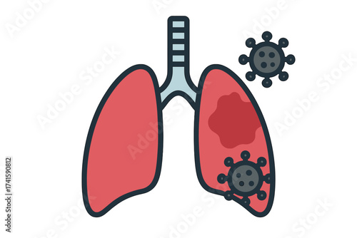 Lungs infected by coronavirus. Pneumonia disease concept. Viral respiratory infection medical vector illustration. Human organ pathology anatomy. Covid-19 illness symbol.