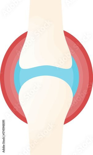 arthritis rheumatoid