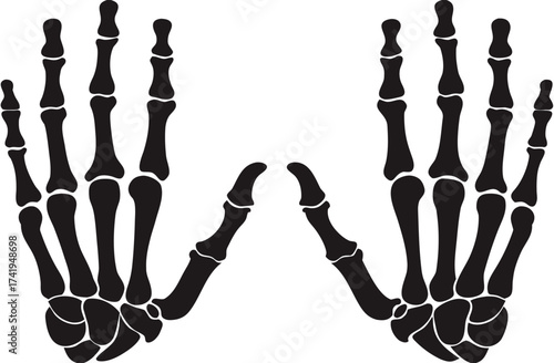 Bones of both hands illustrated on white background

