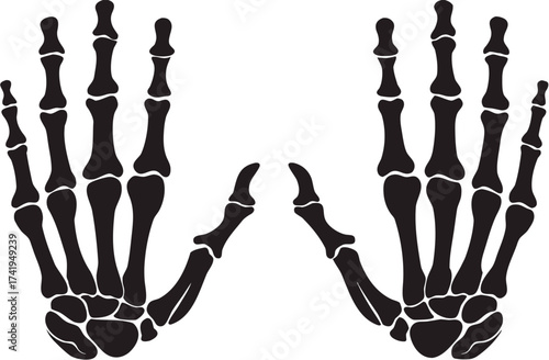 Bones of both hands illustrated on white background


