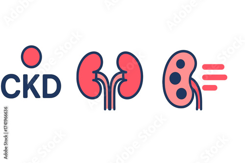 CKD Chronic Kidney Disease vector icon set. Medical infographic for nephrology, urology, and renal failure. Health care illustration of human organs, disease progression and dialysis.