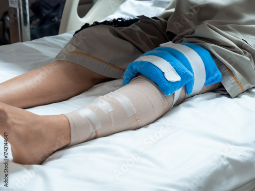 Canvas Print Close-up of injured leg with bandages and cold pack after ACL or meniscus knee surgery