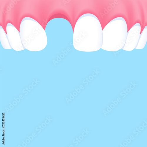 Upper teeth (Missing tooth) - Text box banner (square) illustration vector design. Dental care concept.
