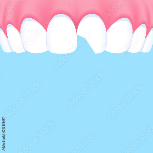 Upper teeth (Chipped) - Text box banner (square) illustration vector design. Dental care concept.