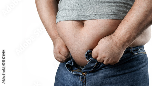 Принти на полотні Obesity concept, close up of overweight man trying to wear too small jeans isola