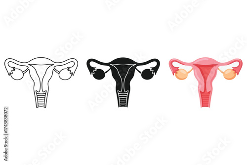 Illustration of the female reproductive system, showing the uterus, ovaries, and fallopian tubes
