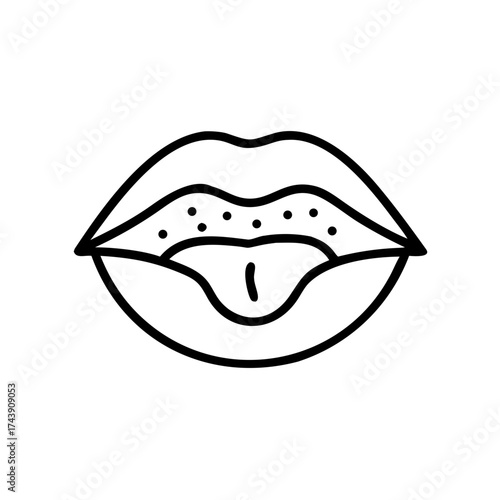 Close-up of mouth showing symptoms of ulceration and discomfort  