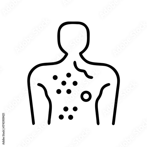Human body outline with hives and skin irritation symptoms  