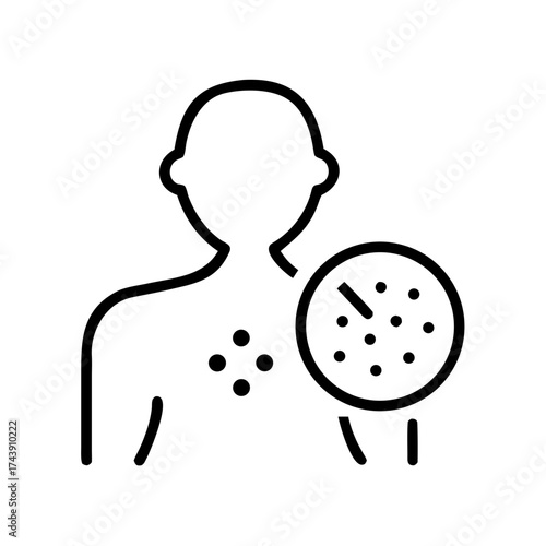 Outline of person with skin allergy testing and spots on chest  