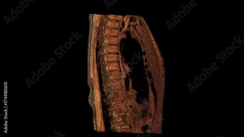 The LS Spine T2W TSE VR Movie presents a detailed 3D view of the lumbar spine with clear soft-tissue contrast. Perfect for radiology learning, spinal imaging analysis, and medical visualization 