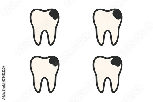Illustration of four decayed teeth with cavities on white background