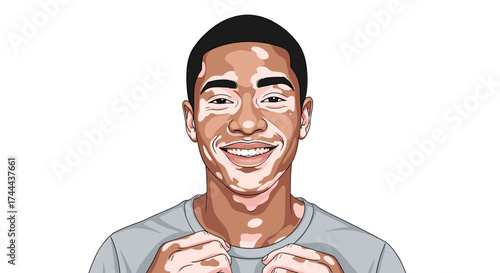 Confident young man with vitiligo smiles warmly, celebrating personal achievement and diversity