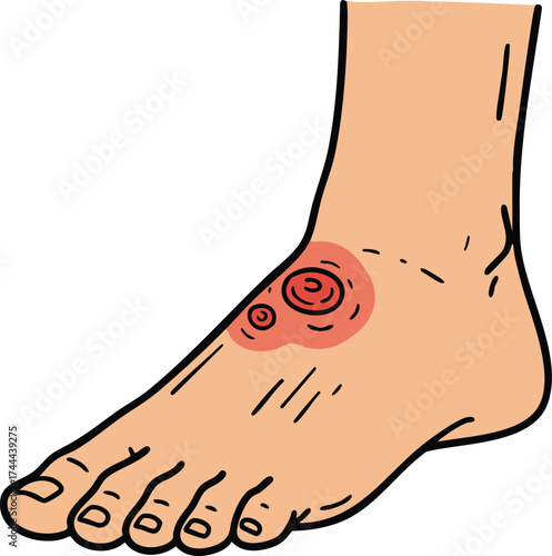 Human foot with infected wound and skin irritation vector illustration showing medical skin condition on ankle 