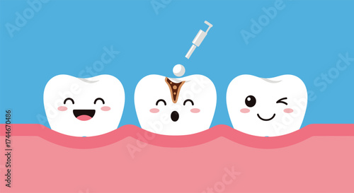 A dental professional is applying a filling to a decaying tooth as its happy and worried neighbors watch.