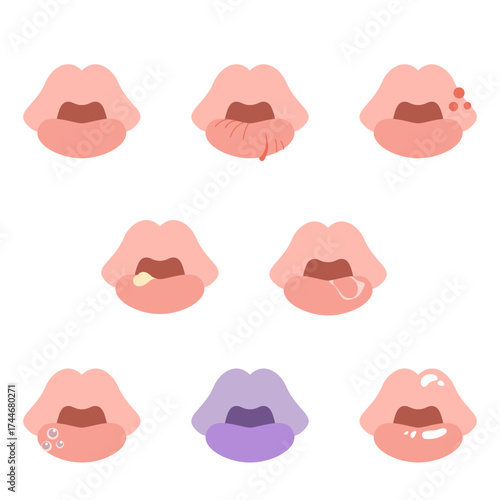 様々な症状の唇セット