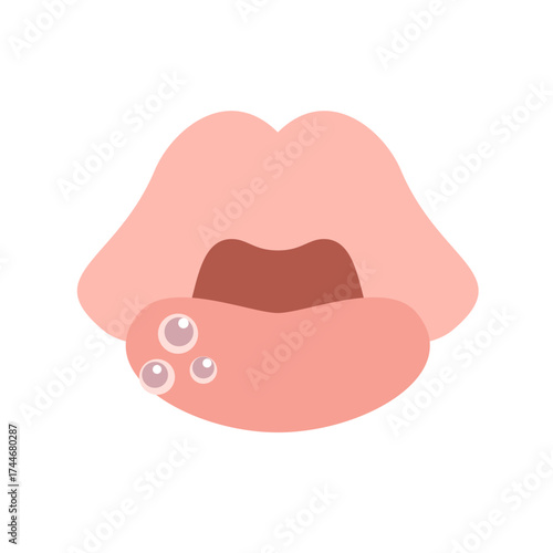 水ぶくれのできた唇