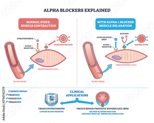 Alpha blockers mechanism diagram shows blood vessel, smooth muscle cell, and receptor interaction for muscle relaxation, transparent background.