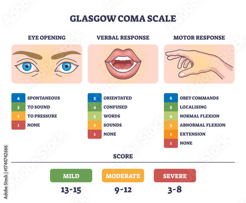 Glasgow Coma Scale diagram shows eye, mouth, and hand icons to outline levels of consciousness assessment, transparent background.