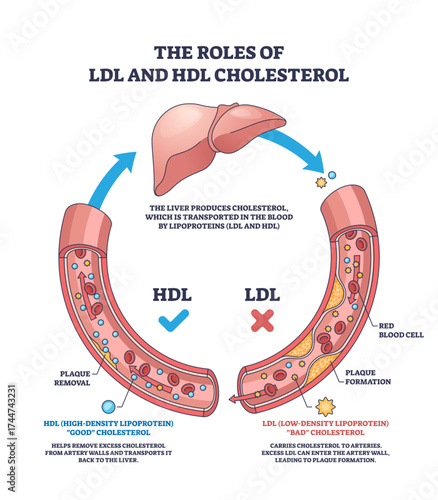 The roles of LDL and HDL cholesterol are shown with a liver, blood vessels, and cholesterol particles, highlighting cholesterol transport and plaque formation, transparent background.